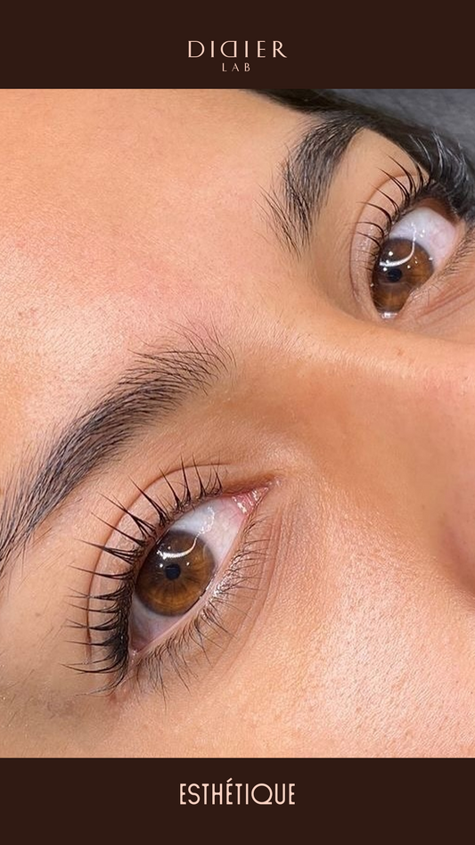 Didier Lab Esthétique skropstu nostiprinošs losjons, 1,5 ml x 10 gab.